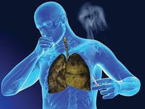 Chỉ với 9 cách đơn giản để loại bỏ mọi độc tố ra khỏi phổi ngay tại nhà